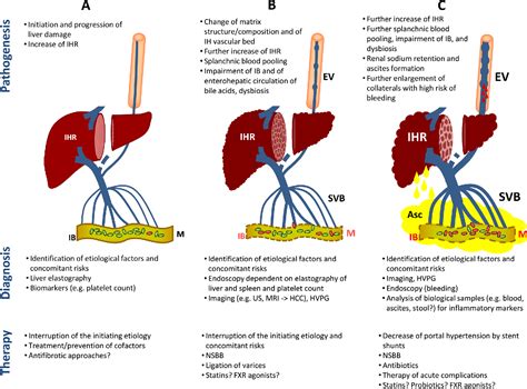 Diagram Of Pathophysiology Of Portal Hypertension The