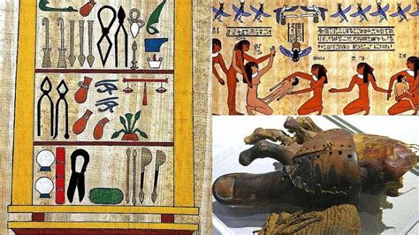 prácticas médicas del antiguo egipto que aún se usan