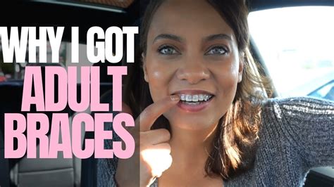 Vlog I Got Braces Cost My Dental Issues Insecurities Brittney Gray Youtube