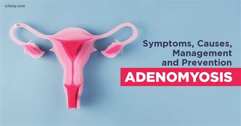 What Is Adenomyosis