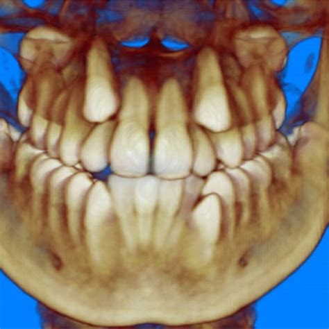 Cbct Volume Rendering Download Scientific Diagram