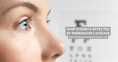 How Vision Is Affected By Parkinsons Disease Parkinsons News Today
