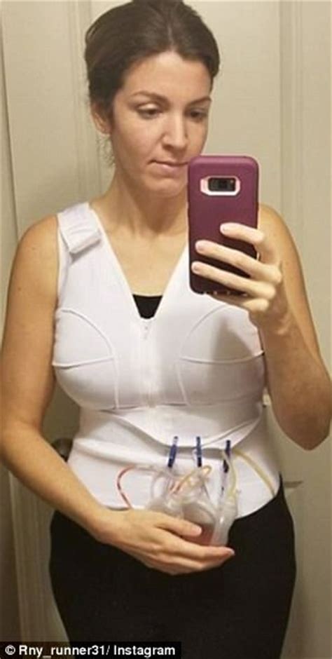 Nebraska Mom Documents Her Loose Skin Removal Surgery Daily Mail Online
