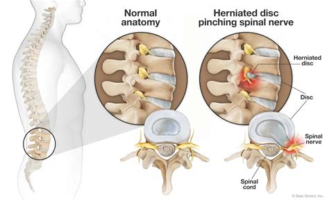 Spinal Health Center Chiropractor In West Dundee Il