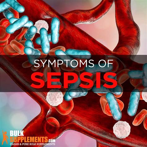 Sepsis Symptoms