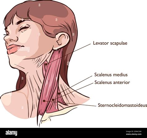 Vector Illustration Of Neck Muscles Anatomy Stock Vector Image Art