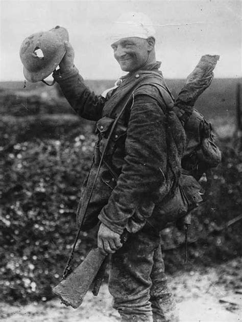 Saved By Shrapnel Helmet This British Soldier On The Way To Hospital