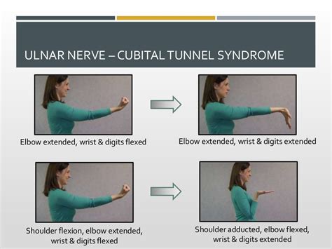 Nerve Gliding Exercises Excursion And Valuable Indications For Ther