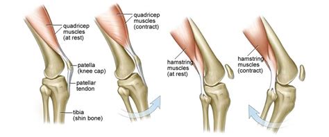 One of the most common ways people hurt their knees is by injuring their acl. Preventing ACL injuries in Sea to Sky - Reach Physio ...
