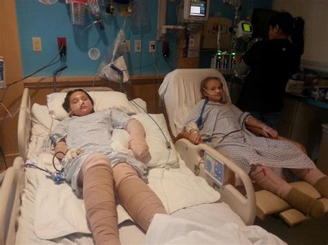 Fundraiser Set To Help Families Of Two Girls Burned In Explosion
