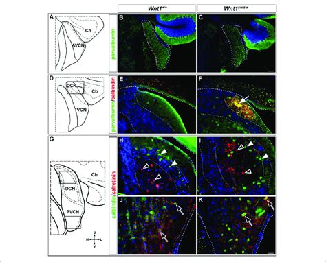 Altered Morphology And Ectopic Cell Types In The Cochlear Nucleus Of
