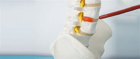 How Do You Know If You Have A Herniated Disc Empower