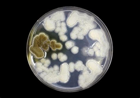 Premium Photo Fungi On Agar Plate