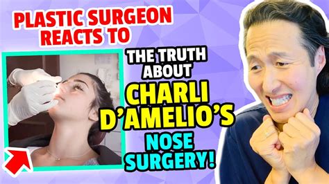 Plastic Surgeon Reacts To Charli Damelios Nose Surgery Dr Anthony