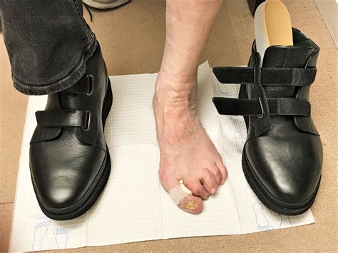 Hand Made Custom And Orthopedic Footwear — Davis Shoe Therapeutics