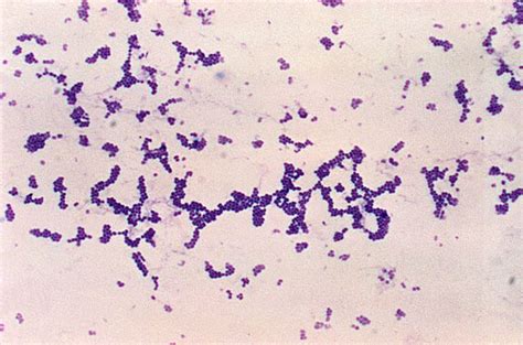 What diseases are caused by staphylococcus aureus? Free picture: photomicrograph, spherical, cocci, gram ...