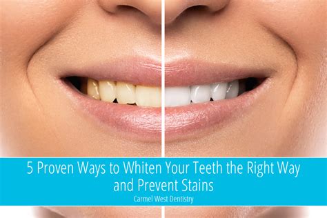 Proven Ways To Whiten Your Teeth The Right Way And Prevent Stains