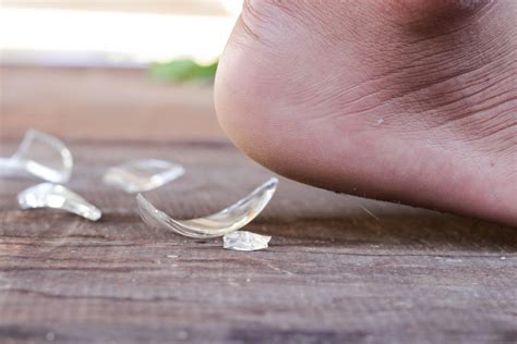 Remove a splinter from your skin (hand, foot, finger,. When to Get Help for a Glass Splinter