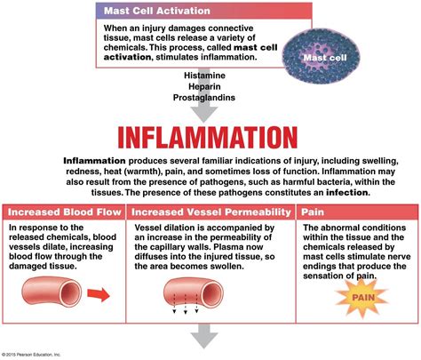 Rubor reddening vasodilation , sticky walls. Signs of Inflammation | Anatomy and physiology ...