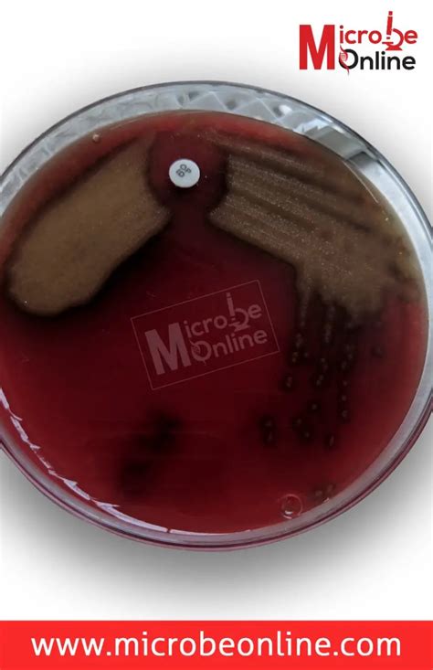 Streptococcus Pneumoniae Properties Pathogenesis And Diagnosis • Microbe Online