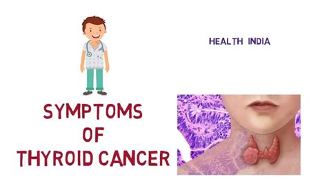 Thyroid Cancer Ke Lakshan Symptoms Of Thyroid Cancer Youtube