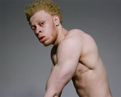 Mr Albino Man