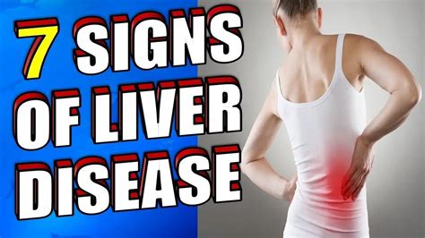 what are the early signs of liver disease 7 symptoms you should know epic natural health