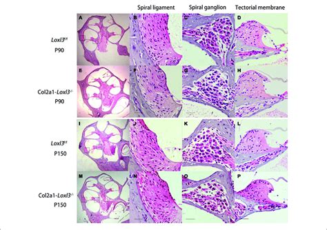 Normal Cochlear Morphology And Progressive Degeneration Of Spiral