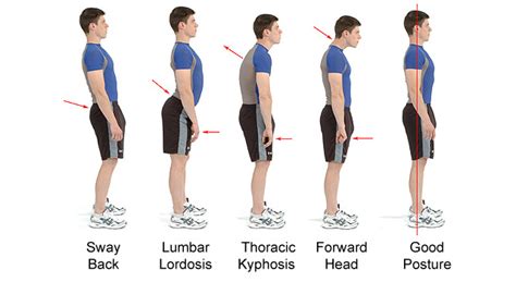 6 Exercises To Help Fix Bad Posture