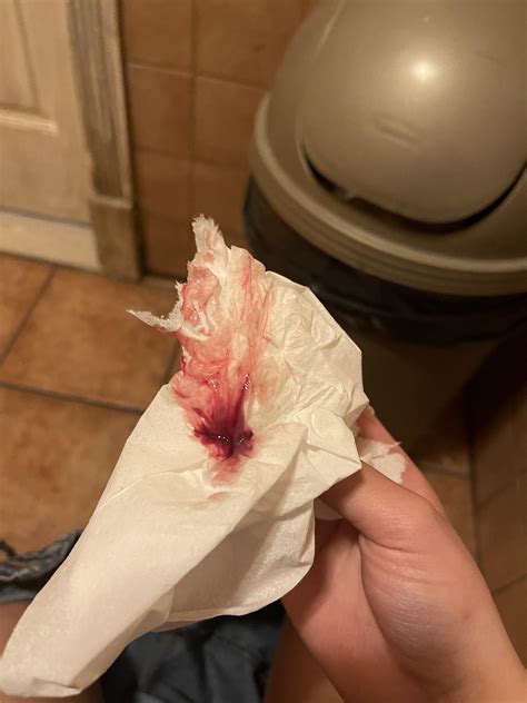 Help Period Or Implantation Bleeding I Cant Tell Graphic Pic R
