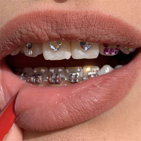 𝙥𝙞𝙣 𝙩𝙝𝙚𝙝𝙤𝙥𝙚𝙚𝙭𝙤 ♡ Tooth Gem Teeth Jewelry Diamond Teeth