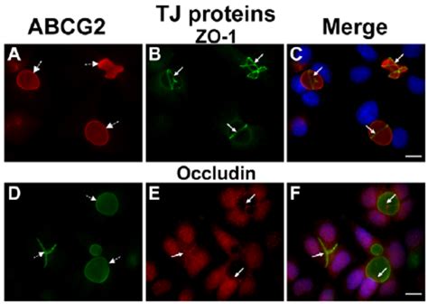 Specific Targeting Of TJ Proteins ZO 1 And Occludin To EVs In MCF 7 MR