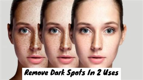 Use This Mask 2 Times To Remove Dark Spots On Your Face Glowpink