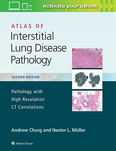 Atlas Of Interstitial Lung Disease Pathology Pathology With High