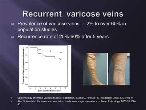 Recurrent Varicose Veins And Its Management Ppt