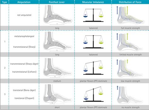 Guide To Partial Foot Amputations