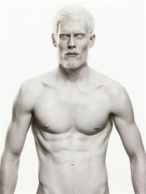 Stephen Thompson Model Albino Ilovehim Albino Men Stephen
