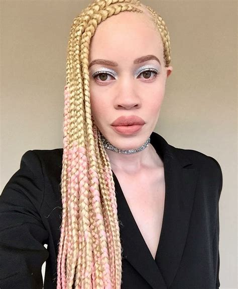 9 Hairstyles Ideas For Albino Women
