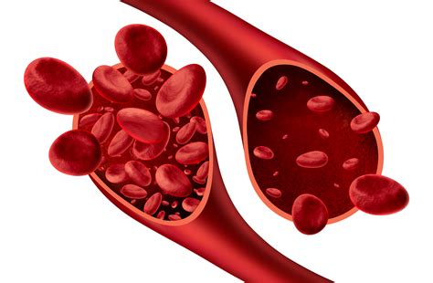 Sintomas Da Anemia Ferropénica Italfarmaco Portugal