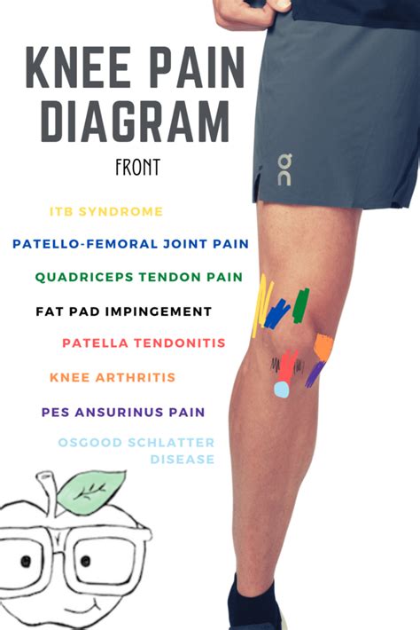Knee Pain Chart Diagnosis The Best Porn Website