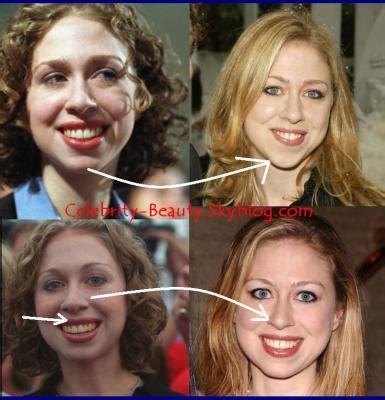 PLANET OF THE CHIMPS #2: Did Chelsea Clinton Get Plastic ...
