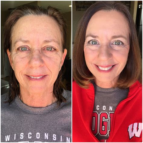 50 Year Old Makeover Before And After All Natural Skin Care Natural