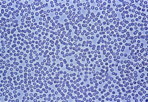 Light Micrograph Of A Group Of Red Blood Cells Stock Image P242