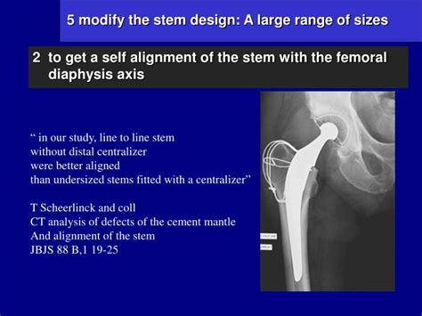 Ppt The Charnley Kerboull Hip System Results Of A 30 Years Experience