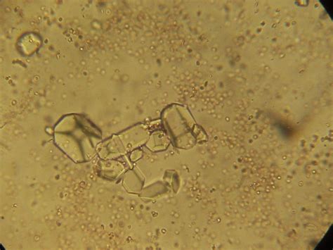 The cuyahoga falls veterinary clinic tell us that there are several factors which influence the formation of struvite crystals in cats namely: Dr Liz... the vet from Russell Vale Animal Clinic: Musings ...
