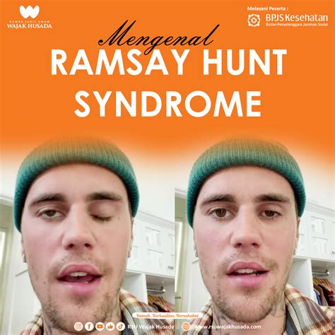 Mengenal Ramsay Hunt Syndrome Rsu Wajak Husada