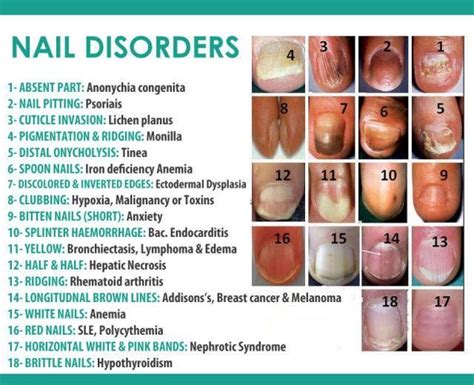 Pin By Barbara Mullins On Health And Beauty With Images Nail
