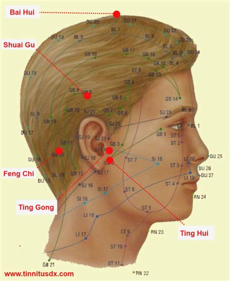 Top 14 Tinnitus Acupressure Points All Acupuncturists Use Tinnitusdx