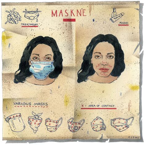 Maskne Is The New Acne And Heres What Is Causing It The 44 Off