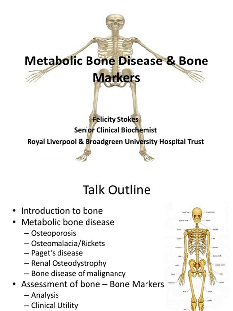 Metabolic Bone Disease And Bone Markers Slides Bone Osteoporosis